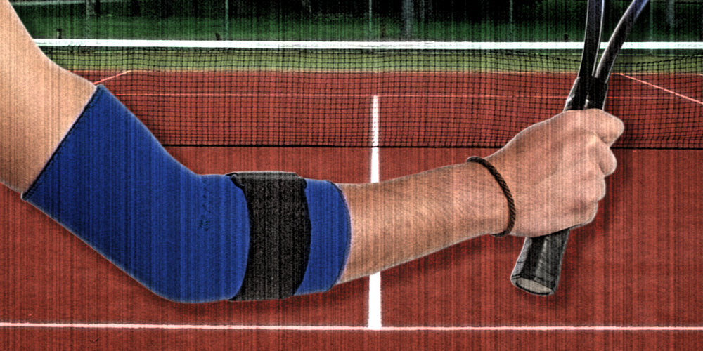 Johns Hopkins Health Talks Tennis Elbow